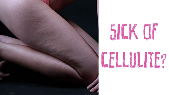 cellulite is unavoidable